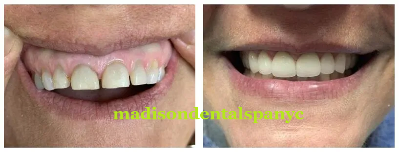 Why Madison Dental Spa is the Top Choice for Smile Makeovers